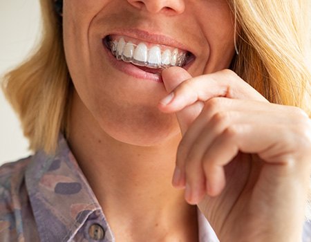 Your Invisalign aligners will give you a beautiful smile you can feel good about