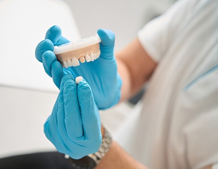 Dentist’s gloved hands placing sample crown over model abutment tooth