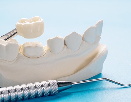 Dental crown over model tooth next to dental instruments on light blue surface